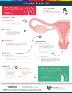 In Vitro Fertility IVF Information Sheet