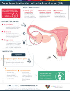 Donor Insemination (IUI) infographic Rainbow Fertility 
