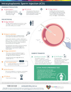 ICSI infographic Rainbow Fertility 